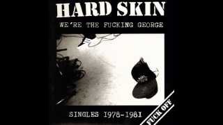 Hard Skin - Who's that boy?