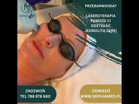 Laserowe usuwanie przebarwień