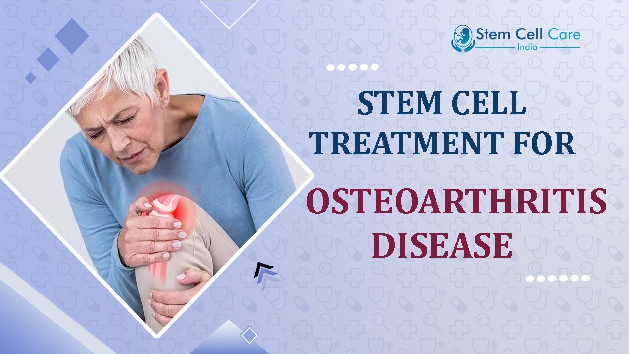 Osteoarthritis | Stem Cell Treatment For Osteoarthritis | Best Treatment For Osteoarthritis 