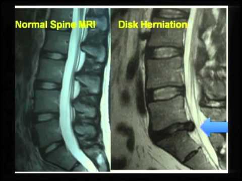 TEDXIBYORK - Kieran Murphy