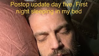 AC joint reconstruction surgery postop day five update￼