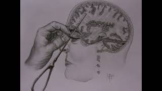 Cover art for lobotomy extended version