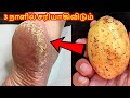 பாத வெடிப்பு குதி கால் வலி சரியாகி மெ�