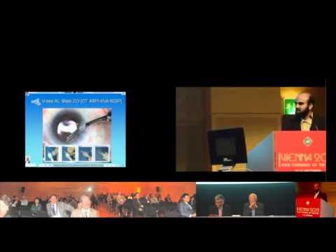 ESCRS-Vienna 2011-Comparison between Two Aspheric Preloaded IOL Insertion systems