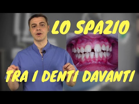 A causa di quello che cè la posizione di posti di pigmentary Ragazze simpatice con lentiggini