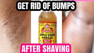 HOW TO GET RID OF BUMPS AFTER SHAVING ANYWHERE!!! no more razor bumps, no more ingrown hairs!!