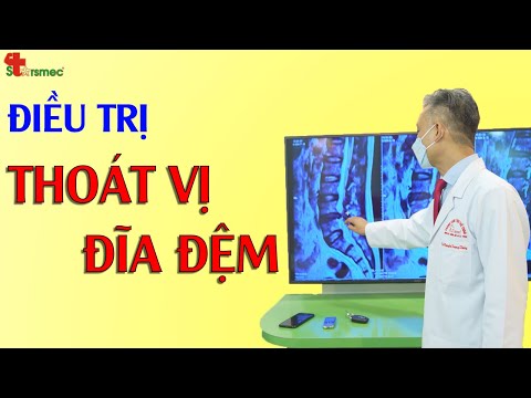 Thoát vị đĩa đệm lâu năm - Điều trị thế nào?