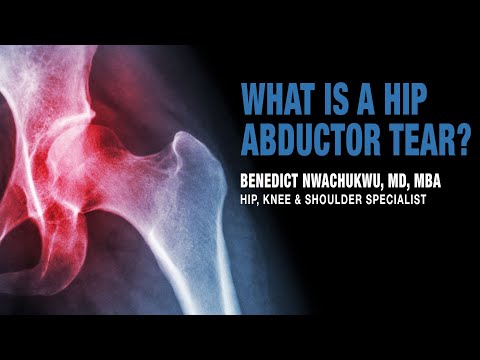 What is a Hip Abductor Tear | Trochanteric Pain Syndrome Treatment | Manhattan, New York, Brooklyn