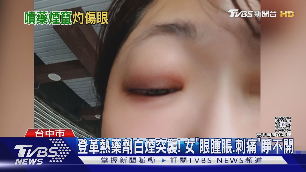 工作突遇白煙襲！女子「眼睛慘腫流膿」原來接觸到「這藥劑」