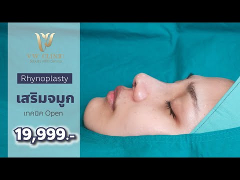 ก่อนเสริมจมูกต้องดูคลิปนี้