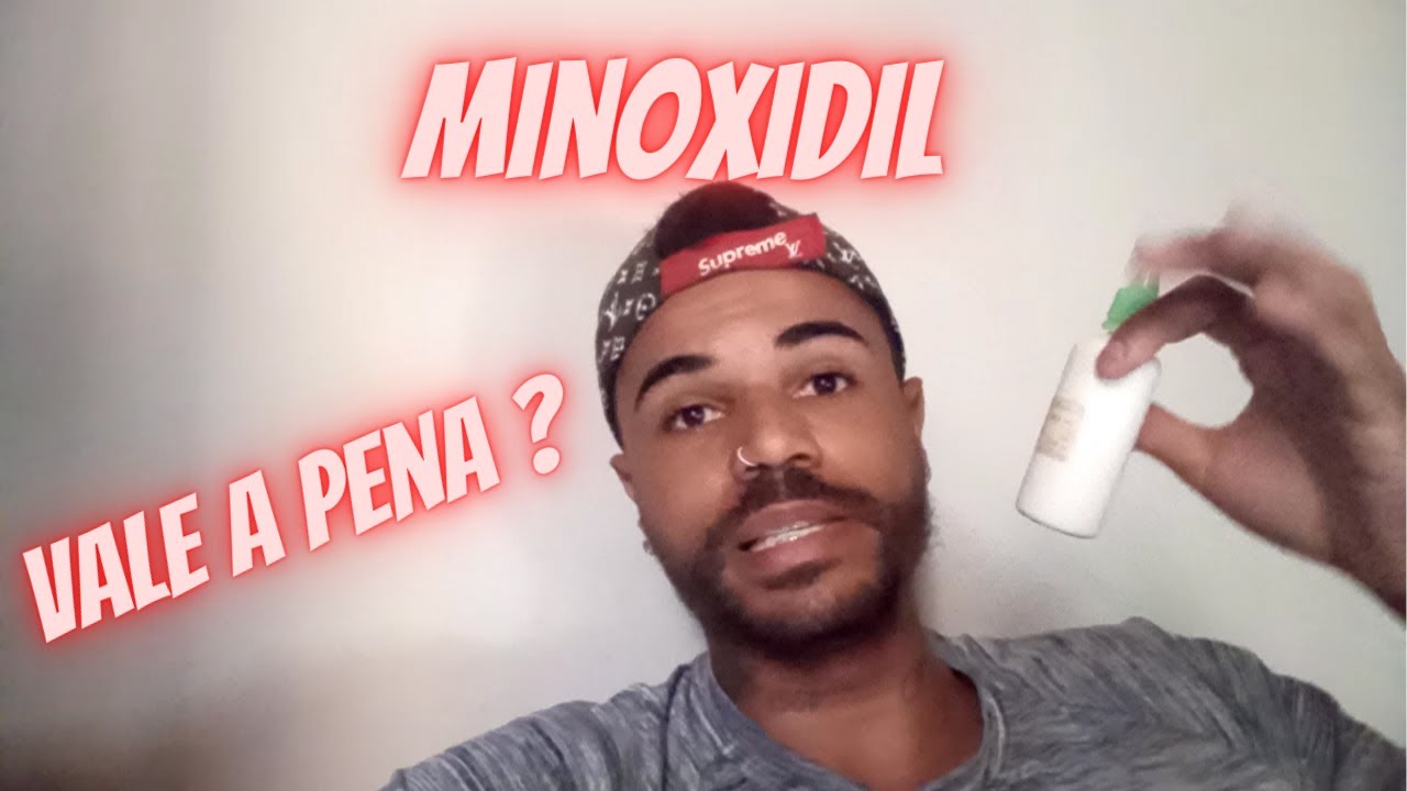 Minoxidil - Meu Depoimento - Minoxidil Antes e depois - Minoxidil Manipulado