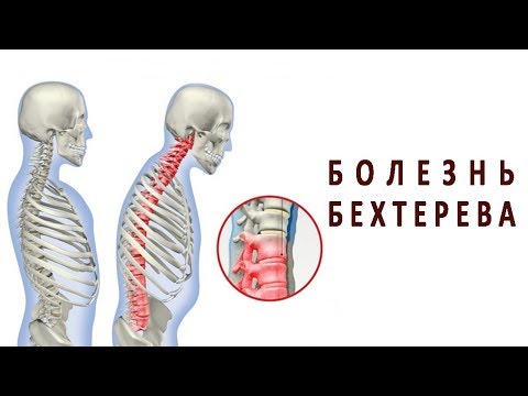 Боль в спине в тазу Массаж на шейный остеохондроз екатеринбург