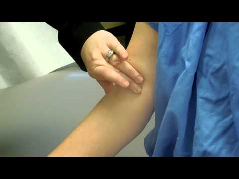 PV UE Brachial Pulse 2 3d