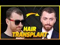 Sam Smith Hair Transplant Breakdown