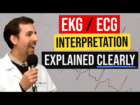 EKG-Interpretation leicht gemacht – So lesen Sie ein 12-Kanal-EKG systematisch!