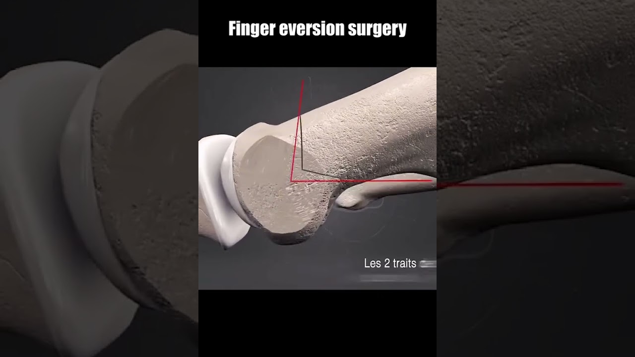 Marcos Michell Garcia Herrera-8