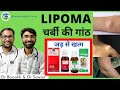 Homeopathic Medicine For Lipoma Treatment Of Fatty Lumps Lipoma Homeopathic Medicine