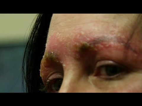 download lagu mp3 mp4 Microblading In India, download lagu Microblading In India gratis, unduh video klip Microblading In India