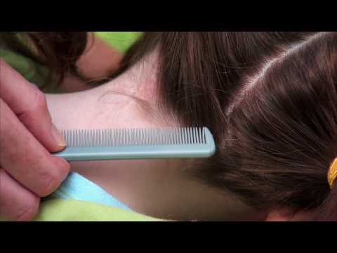 How to check your child for head lice