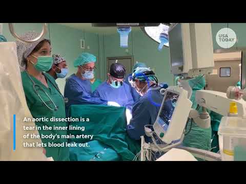 Lindsey Graham's death, aortic dissection diagnosis