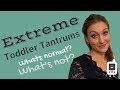 Extreme Toddler Tantrums What S Normal What S Not