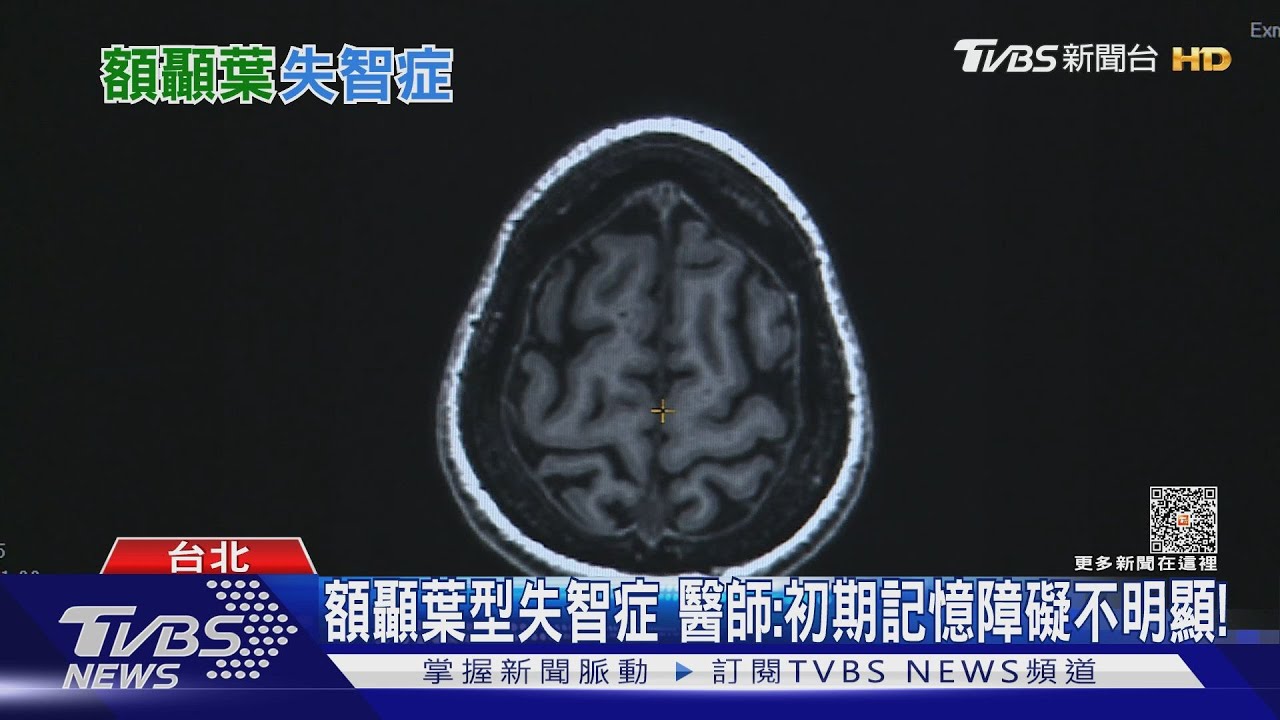出現行為異常語言障礙 是早期徵兆若疏忽下場慘!
