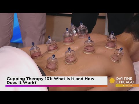 Cupping Therapy 101: What Is It and How Does It Work?