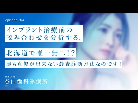 第204話 インプラント治療前に「歯が割れた原因」の咬み合わせを分析する‼️-北海道で唯一無二⁉️-他では真似が出来ない咬み合わせの診査診断方法なのです❗️