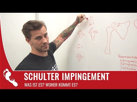 Impingement Syndrome | Meaning & Causes