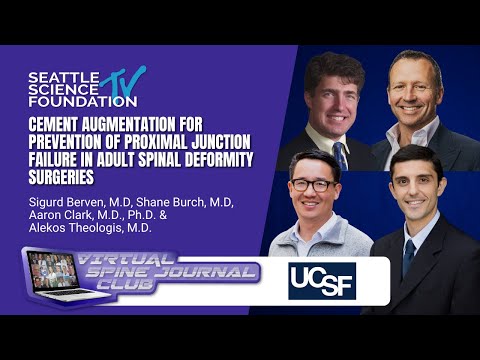 Cement Augmentation for Prevention of Proximal Junction Failure - UCSF Spine Center