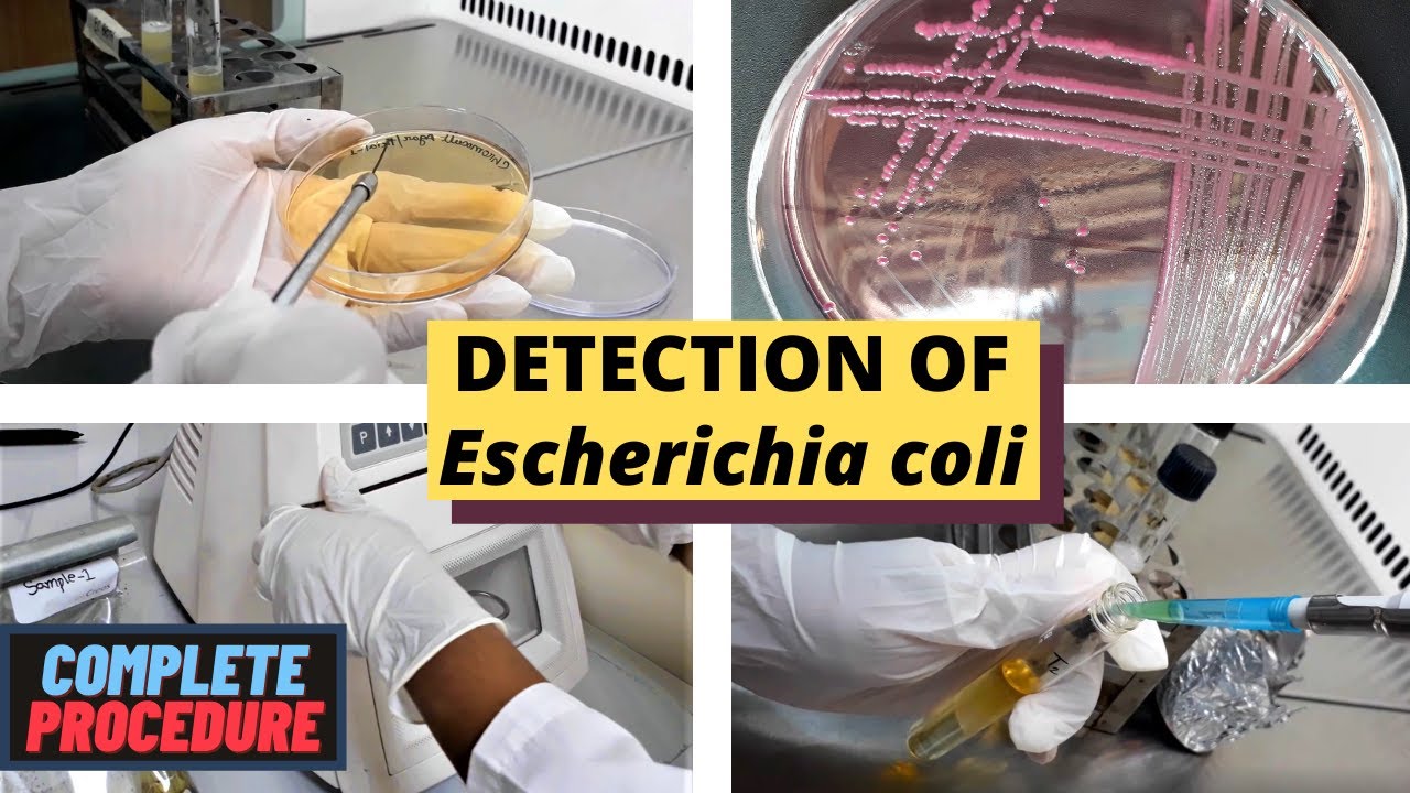 Detection of Escherichia coli (E. coli)_A Complete Procedure (ISO 9308-1 & ISO 16649)