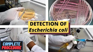 Detection of Escherichia coli (E. coli)_A Complete Procedure (ISO 9308-1 &amp; ISO 16649)