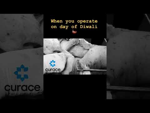 Emergency Hip surgery # Making patient Diwali happy by making him walk and stand after fracture| Dr.Deepak Koli