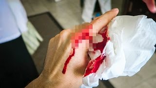 ACCIDENT IN PARADISE (WARNING GRAPHIC)