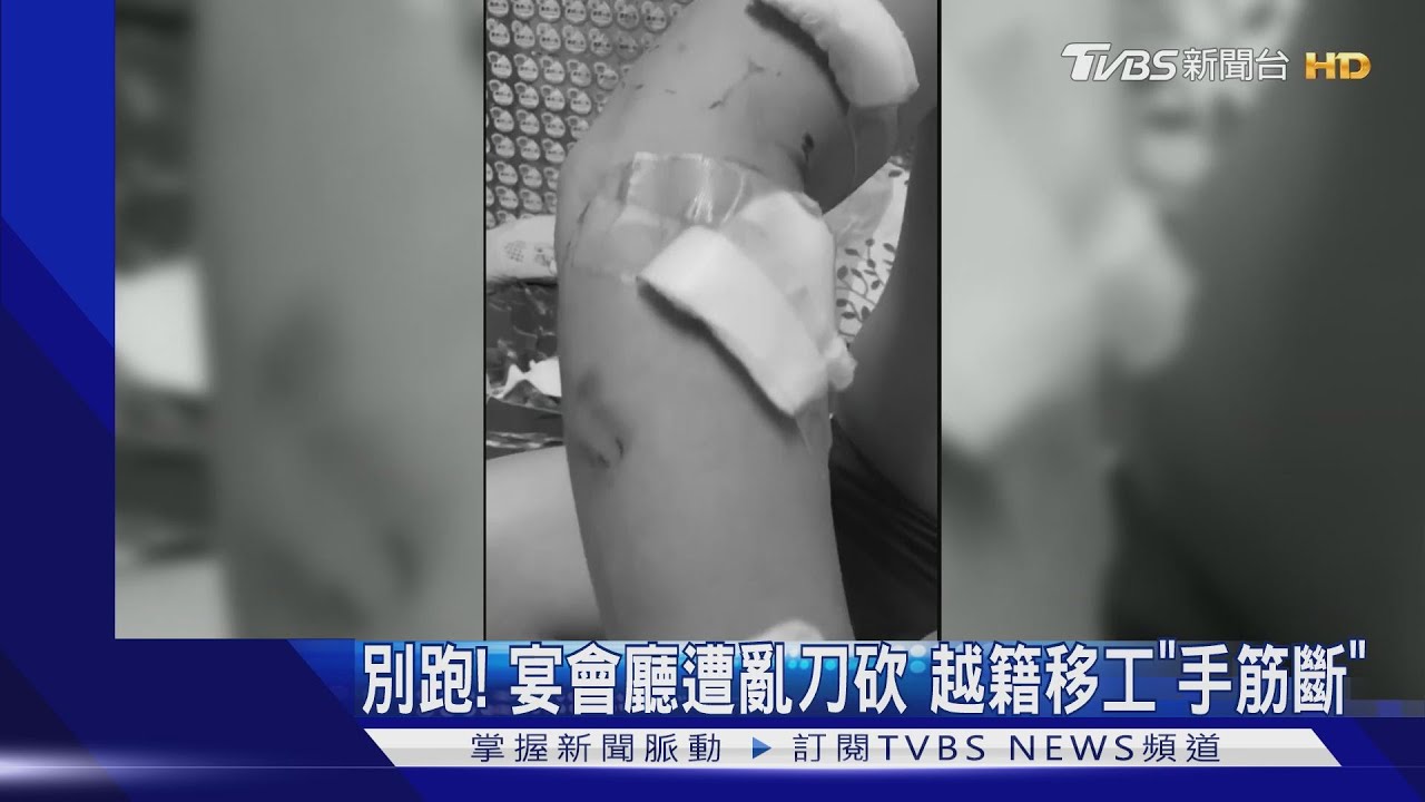 別跑!移工遭「斷手筋」 警急逮教唆越籍女