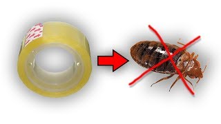 Get rid of bed bugs fast (Simple yet 100% Effective)