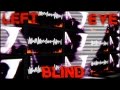 Patient Zero - Left Eye Blind 