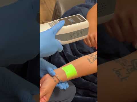 Real Users Share Their Experiences with Ionic Bode Pro