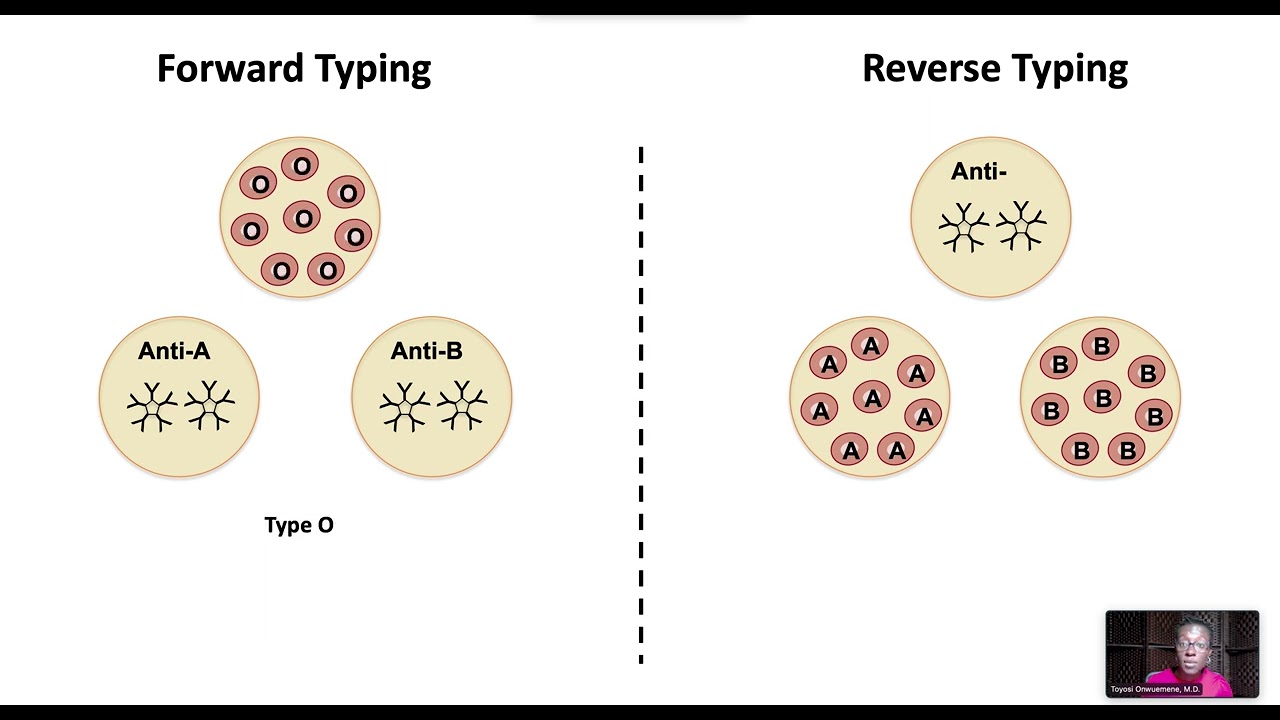 Pre-Transfusion Testing: Type, Screen, and Crossmatch
