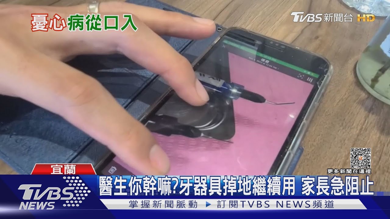 醫生你幹嘛?牙器具掉地繼續用 家長急阻止