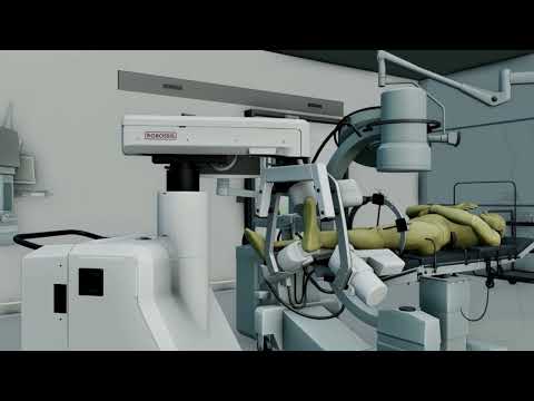Mohammad Abedin-Nasab, Robossis - Robotic system for long-bone fracture alignment | LSI USA '26