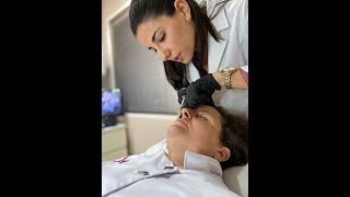 Aumento de labios con ácido hialurónico en Ibiza, Sevilla y Badajoz por parte Dra Yasmin