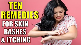 How to Get Rid of Skin Rashes and Itching Naturally