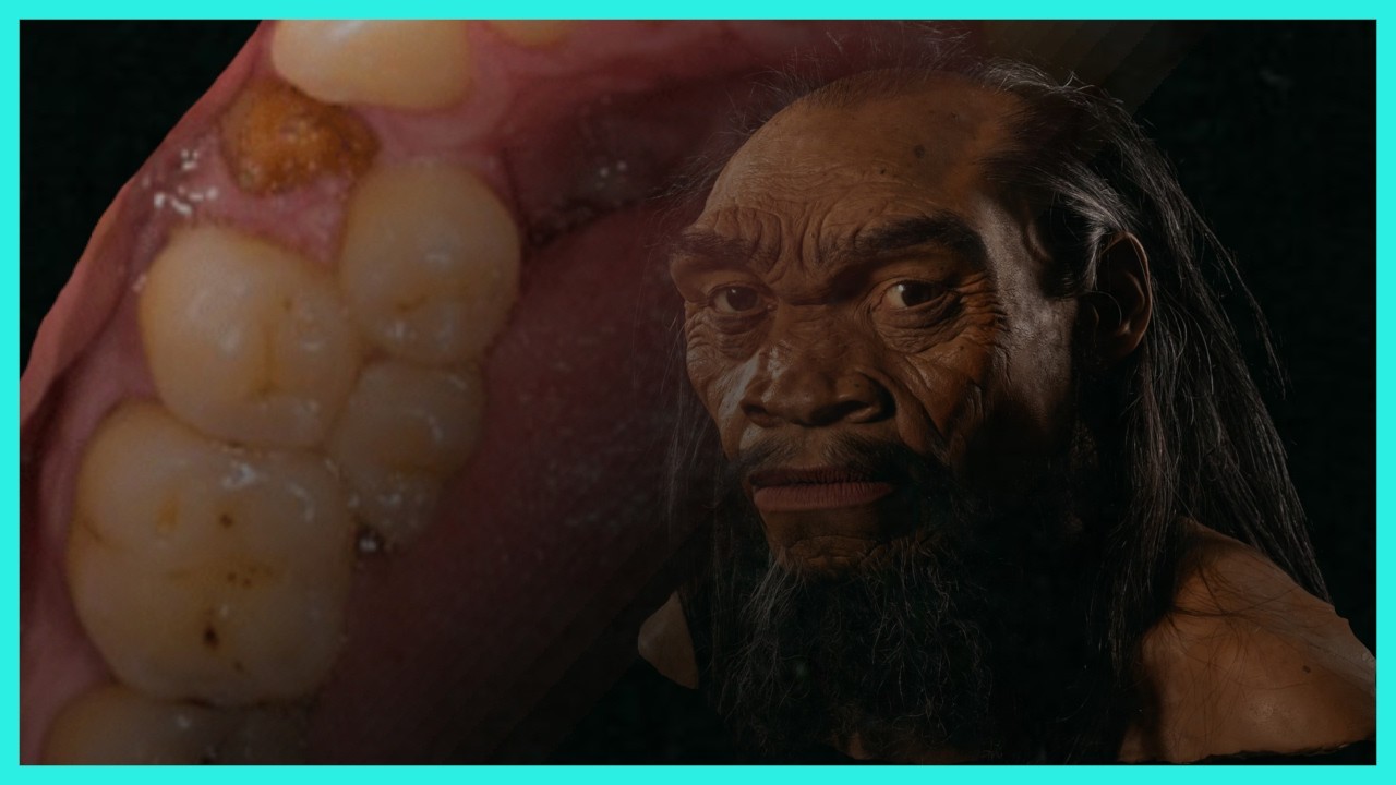Genetic Causes for Giants with 2 Rows of Teeth Explained #science #archaeology #neandertais