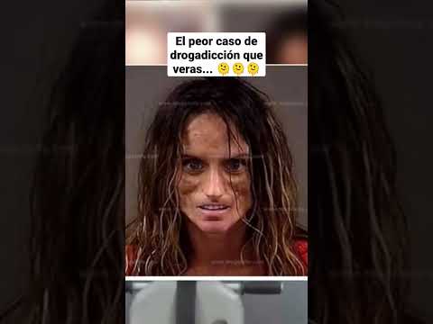 El peor caso de drogadicción que podrás ver 🫠🫠🫠 #drogadicción #terror #drogas #destrucción #shorts