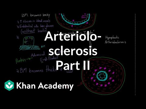 Arteriolosclerosis - part 2 | Circulatory system diseases | Health & Medicine | Khan Academy