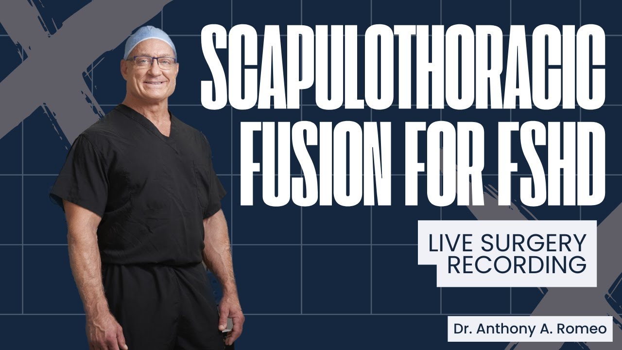 Scapulothoracic Fusion for FSHD