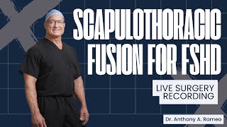 Scapulothoracic Fusion for FSHD -  Anthony A. Romeo, MD