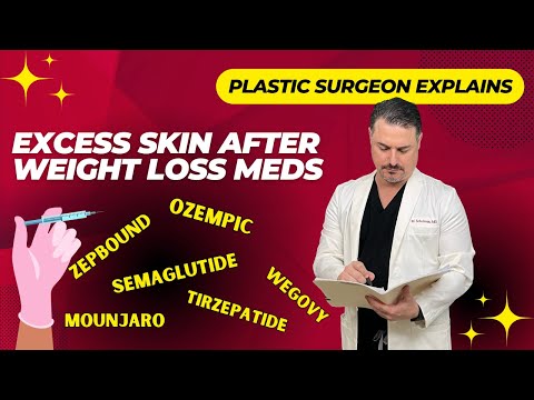 Loose Skin after Ozempic