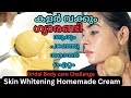 😳Permanent Brightness!!🙊 Face WhiteningCream|Pimple Marks&pigmentation Removal Cream|Bridal cream